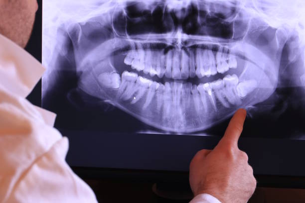Best Cracked Tooth Emergency Dentist  in Taylor, TX